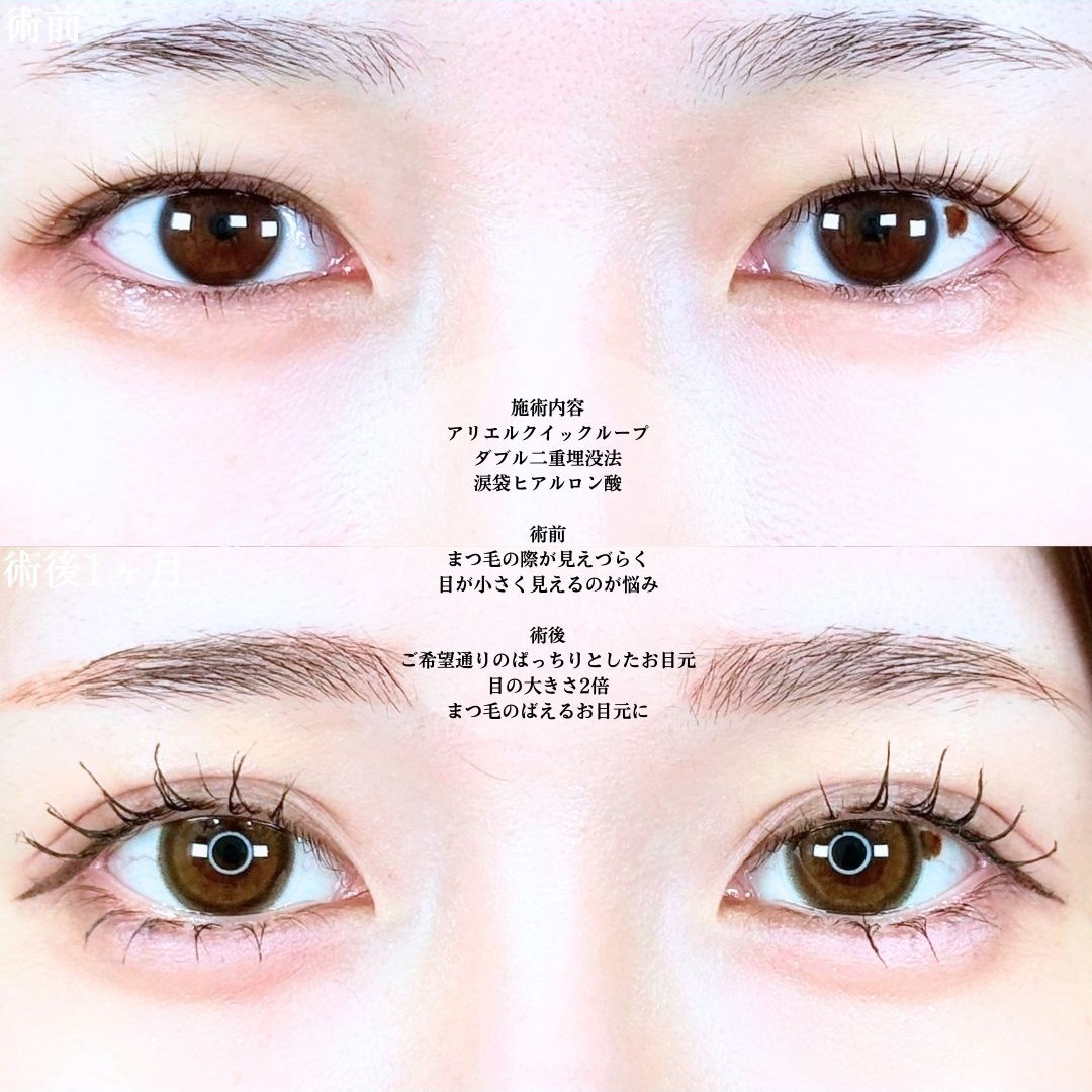 No.19391の症例写真1