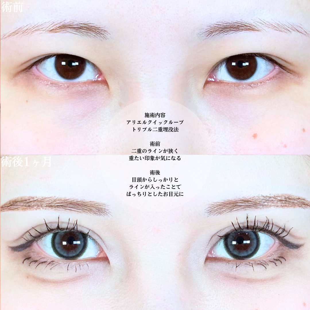 No.19683の症例写真1