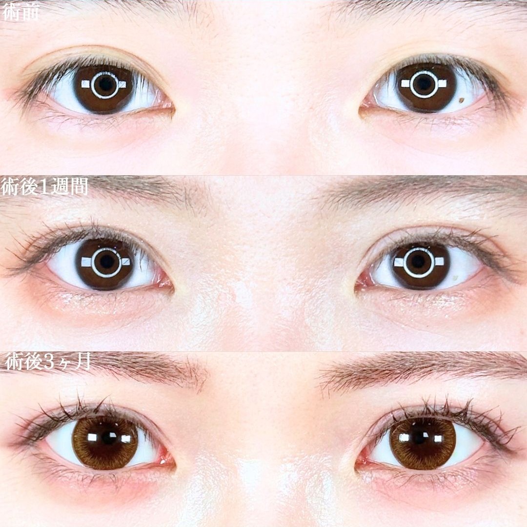 No.19424の症例写真