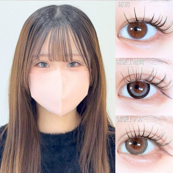 No.19454の症例写真