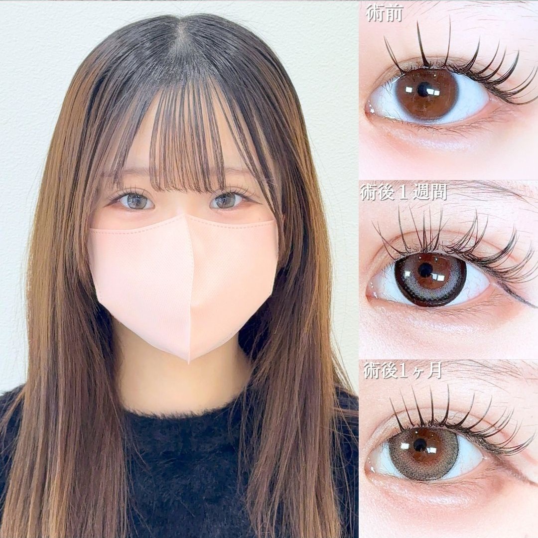 No.19454の症例写真