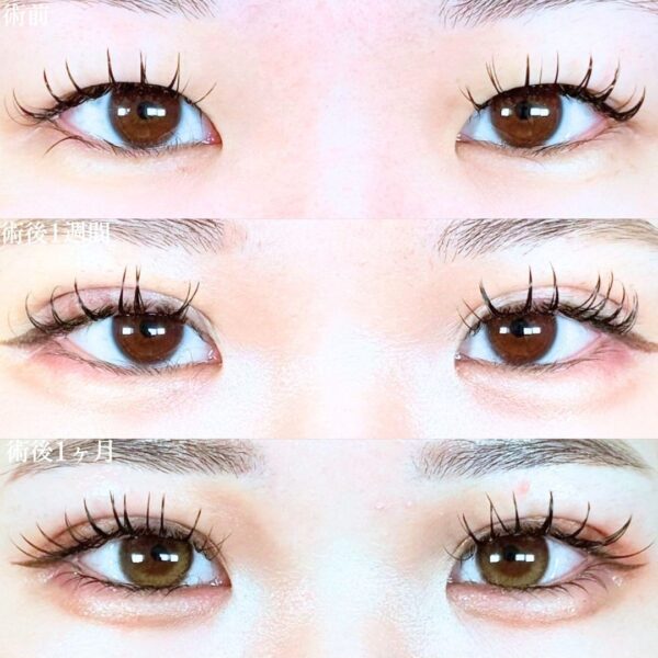 No.19498の症例写真