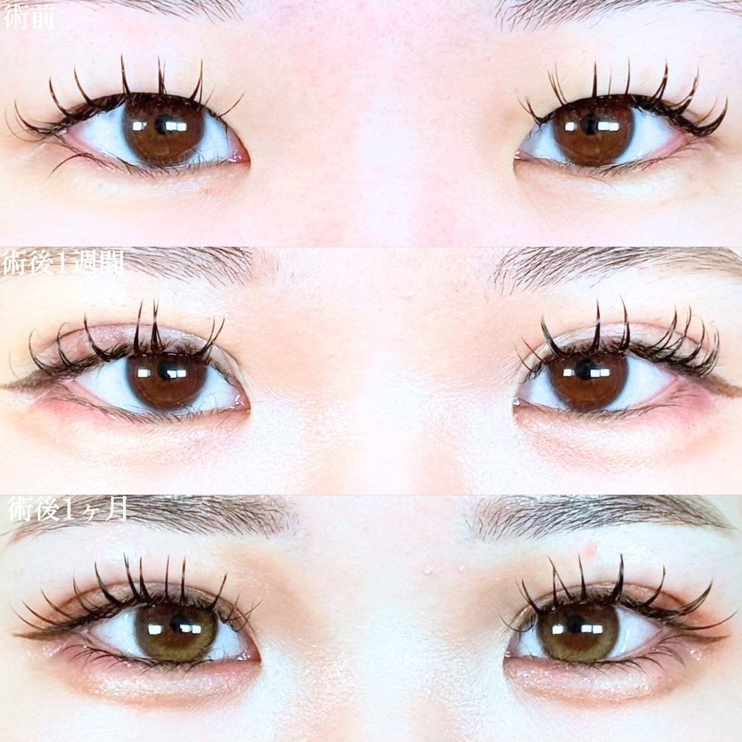 No.19498の症例写真