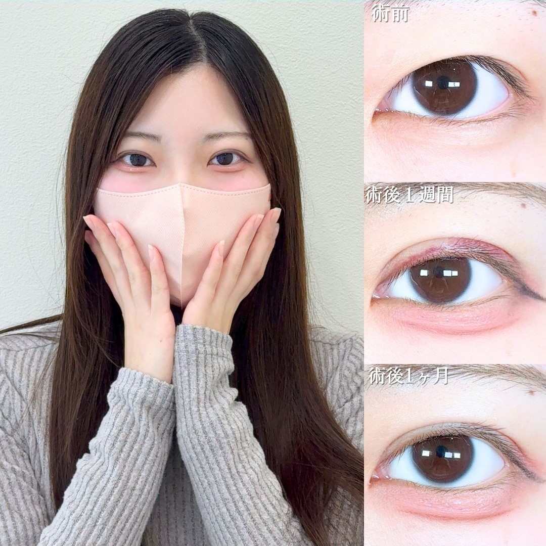 No.19519の症例写真