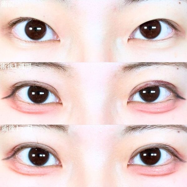 No.19597の症例写真