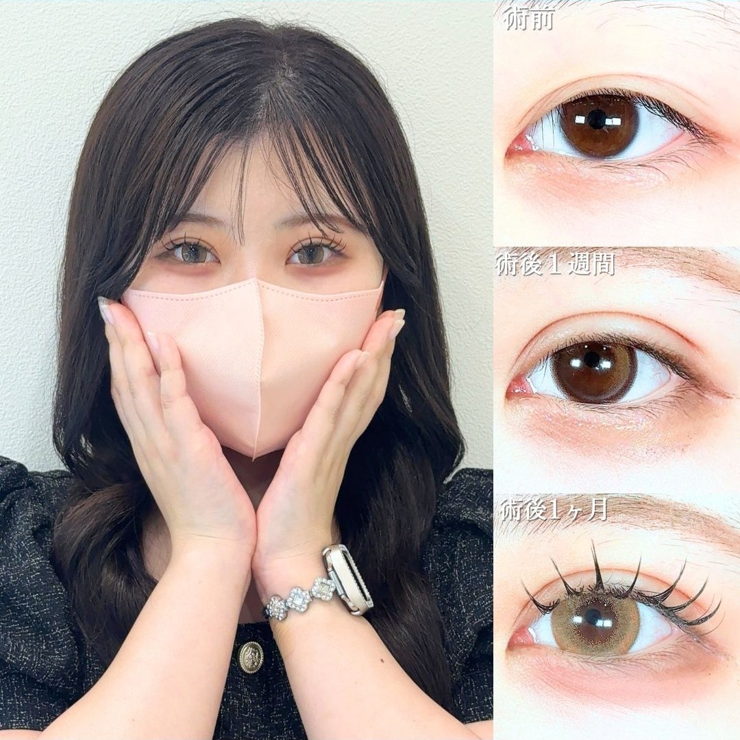 No.19667の症例写真