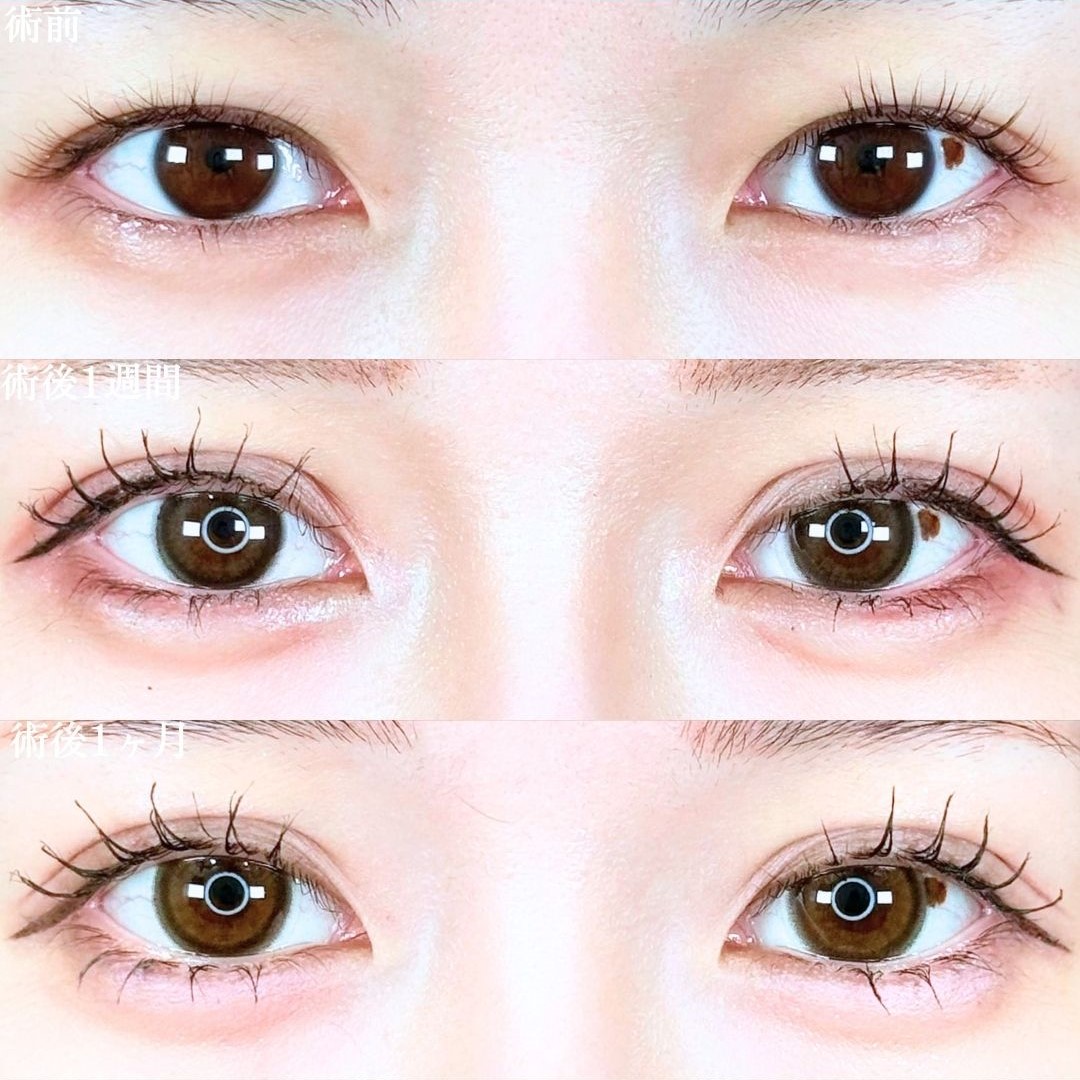 No.19391の症例写真