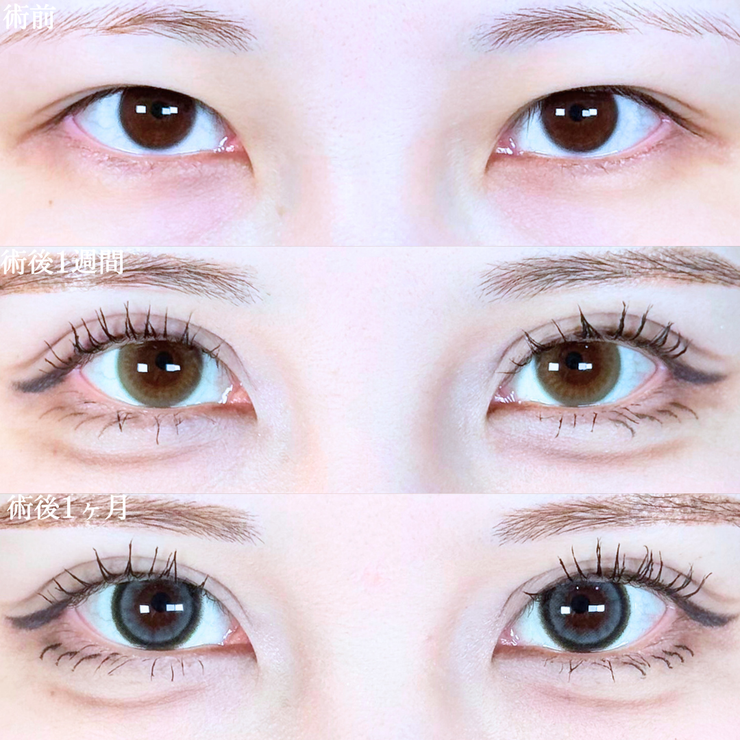 No.19683の症例写真