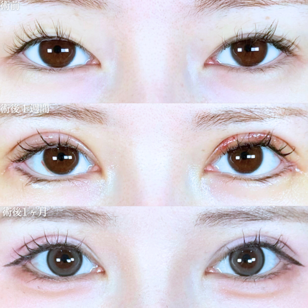 No.19663の症例写真 No.19663の症例写真