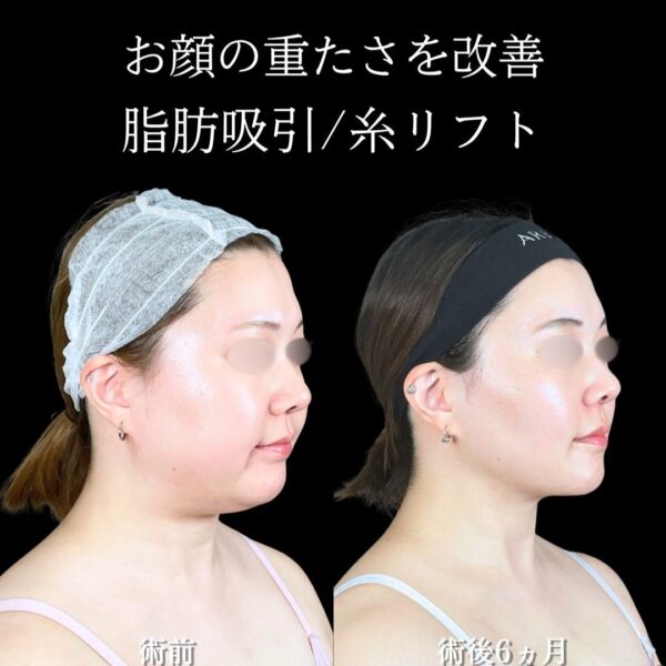 No.19900の症例写真