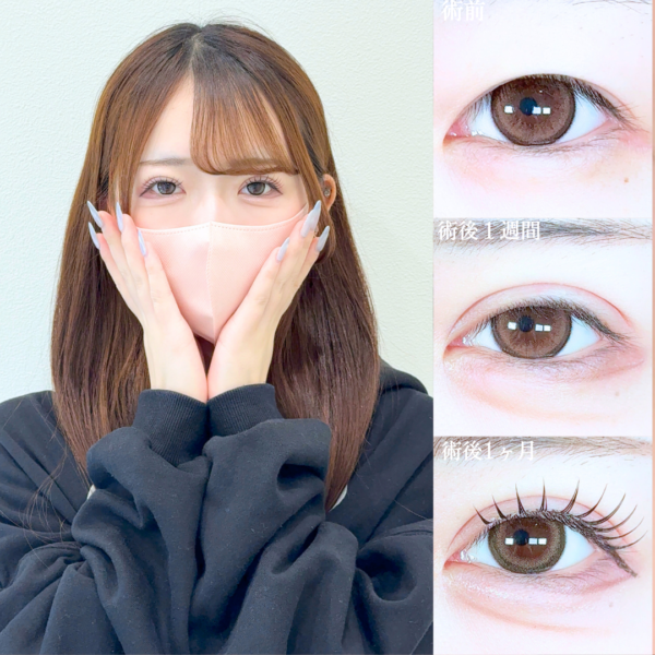 No.19809の症例写真