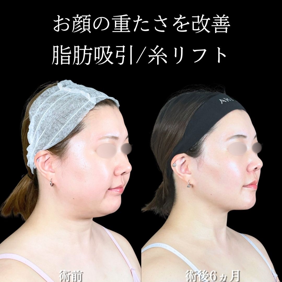 No.19900の症例写真