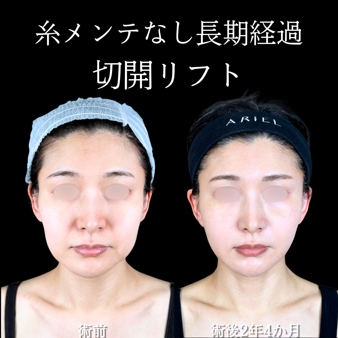 No.20082の症例写真