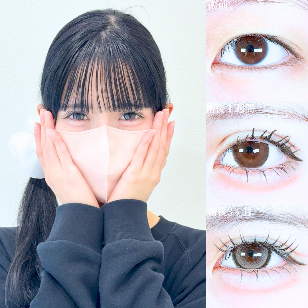 No.20105の症例写真