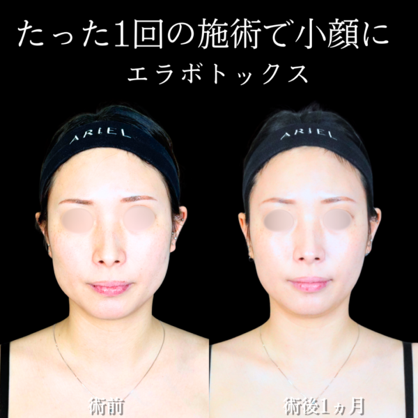 No.20114の症例写真 No.20114の症例写真