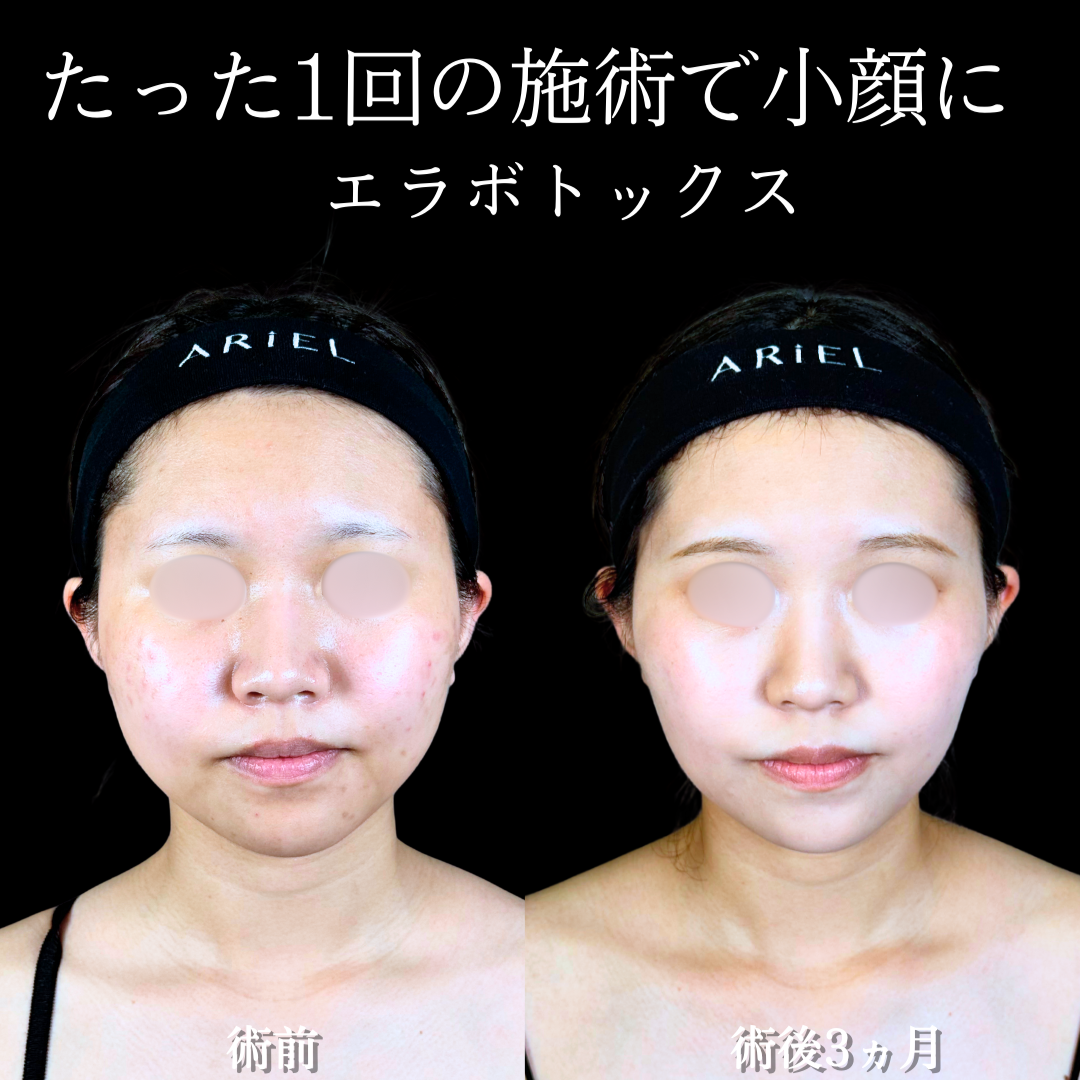 No.19838の症例写真