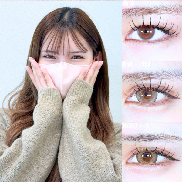 No.19879の症例写真