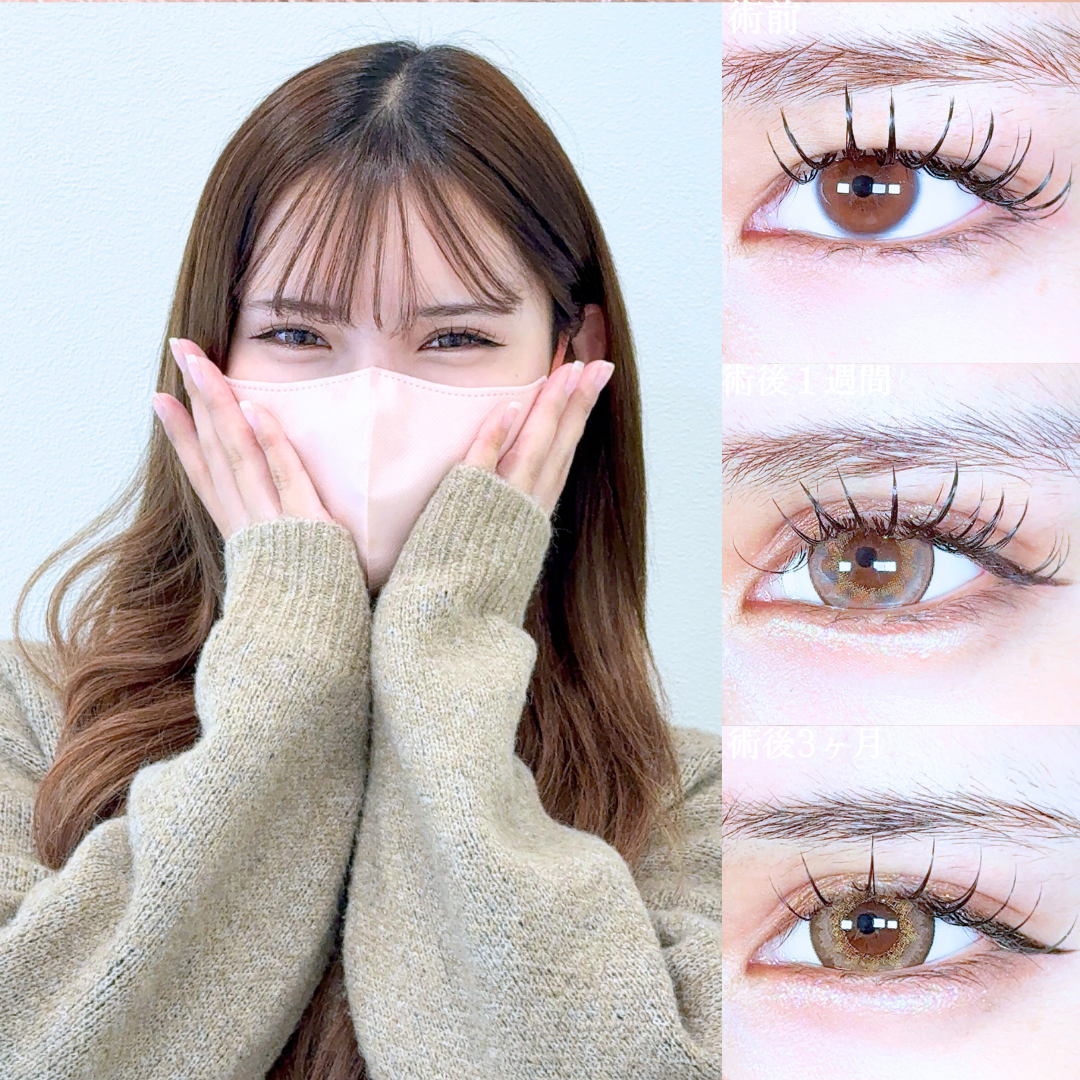 No.19879の症例写真