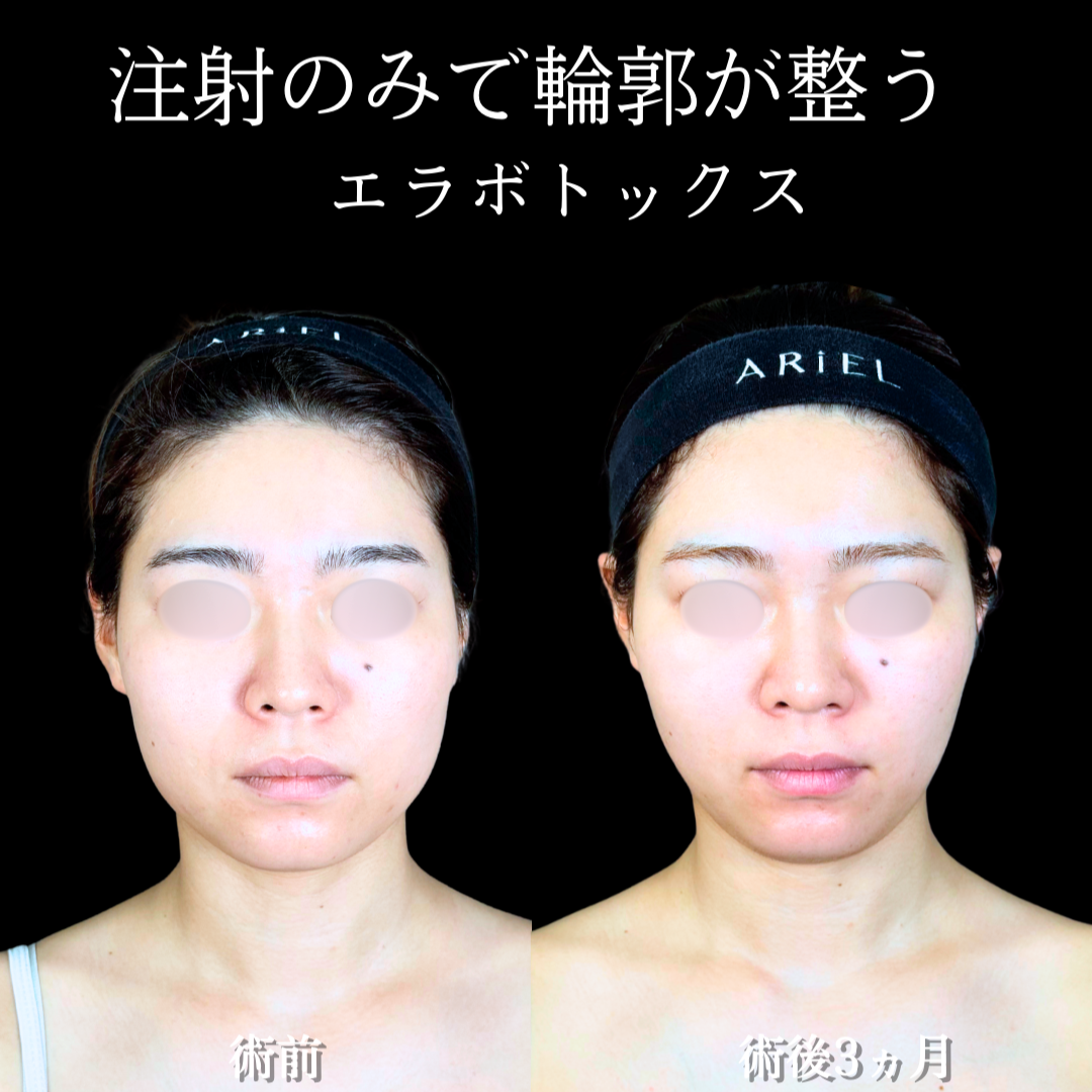 No.19925の症例写真