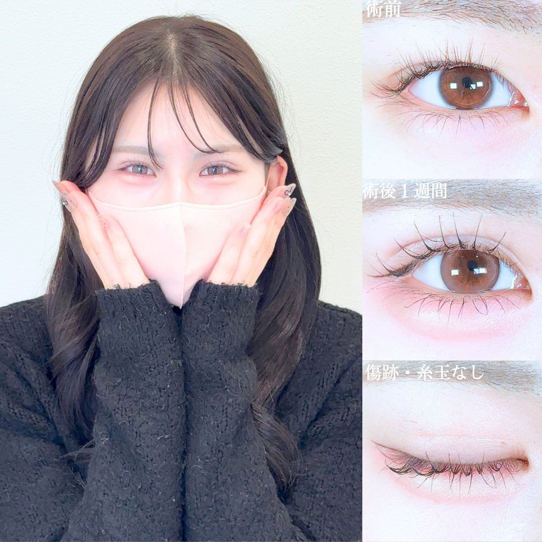 No.19944の症例写真