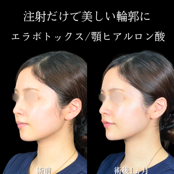 No.19951の症例写真