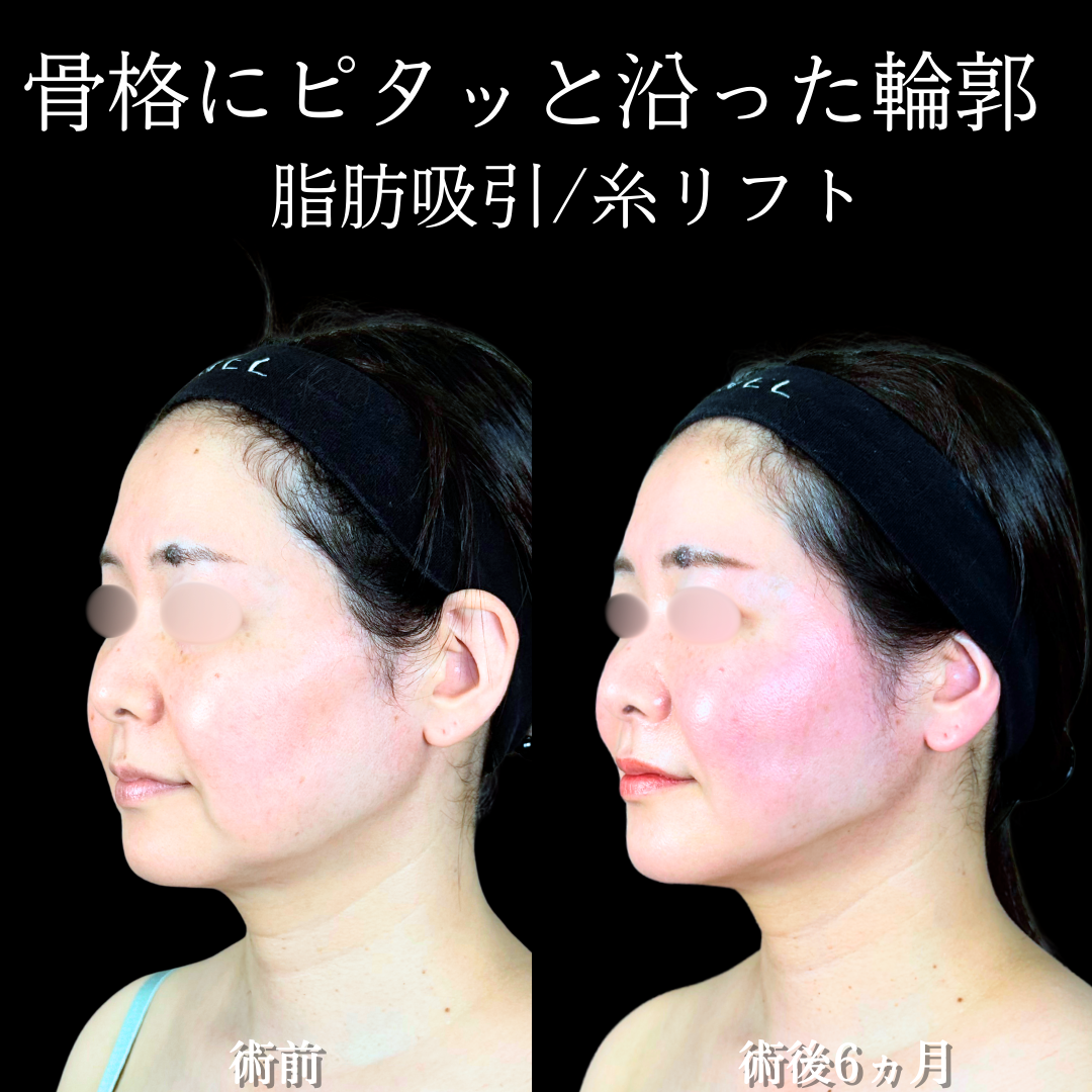 No.19970の症例写真