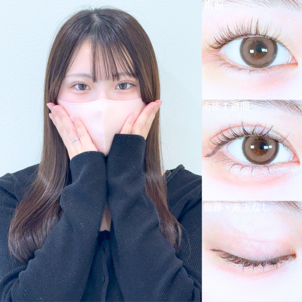 No.19988の症例写真