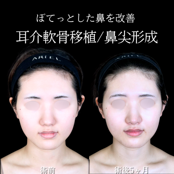 No.20066の症例写真