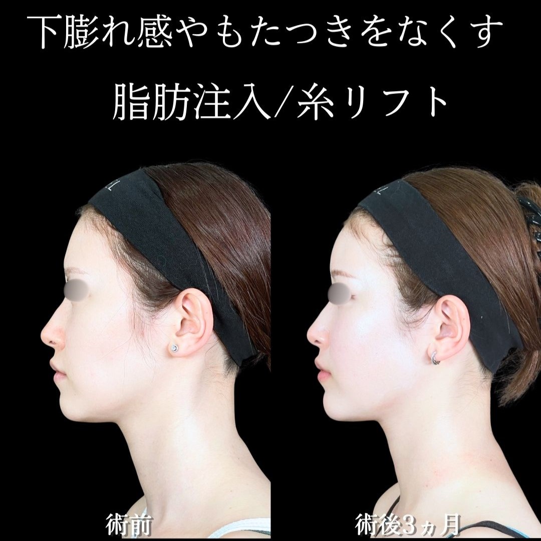 No.19784の症例写真