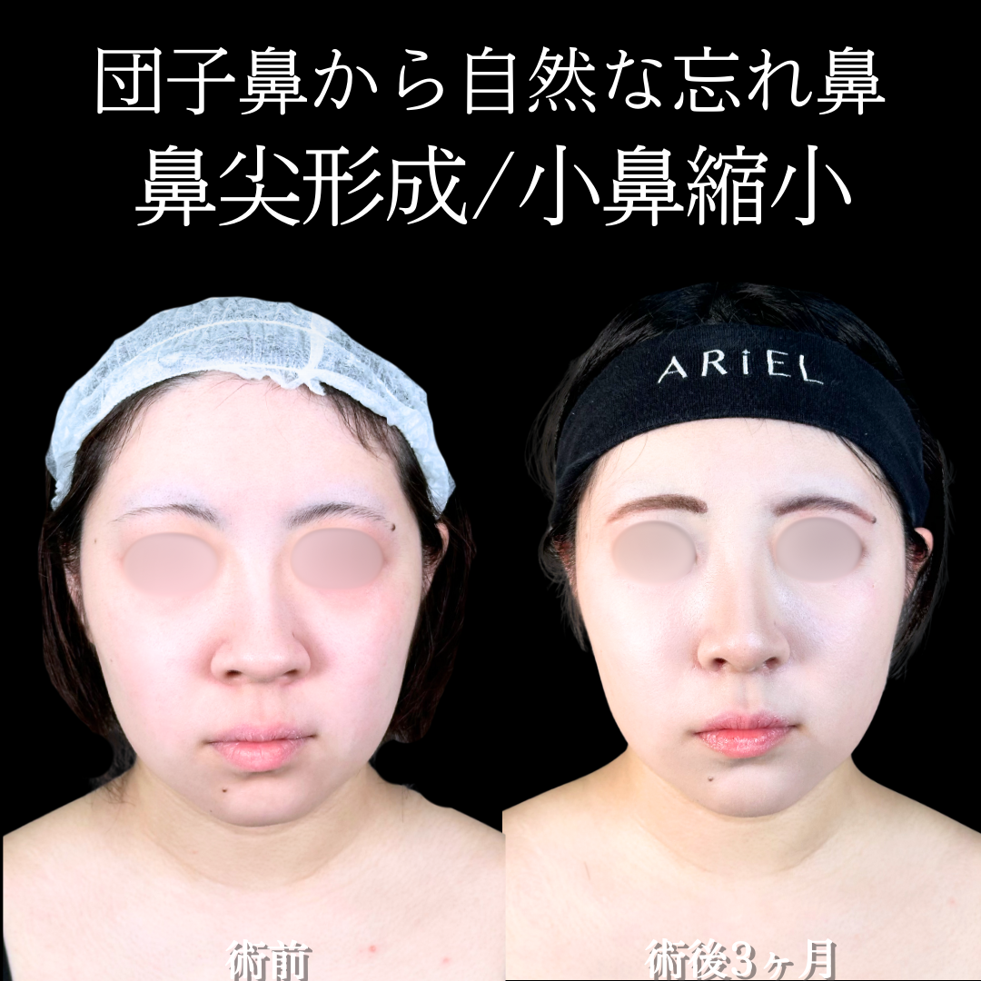 No.19777の症例写真