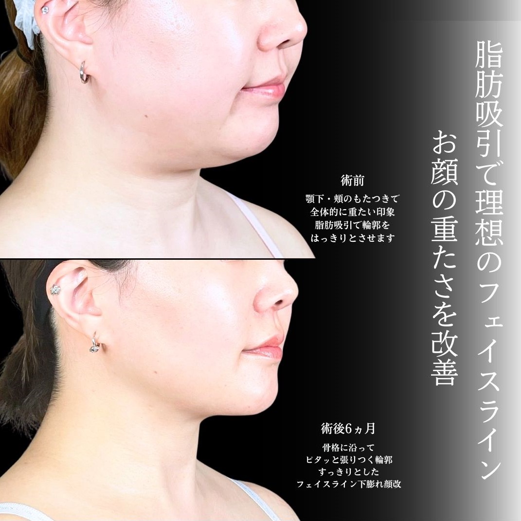 No.19900の症例写真1