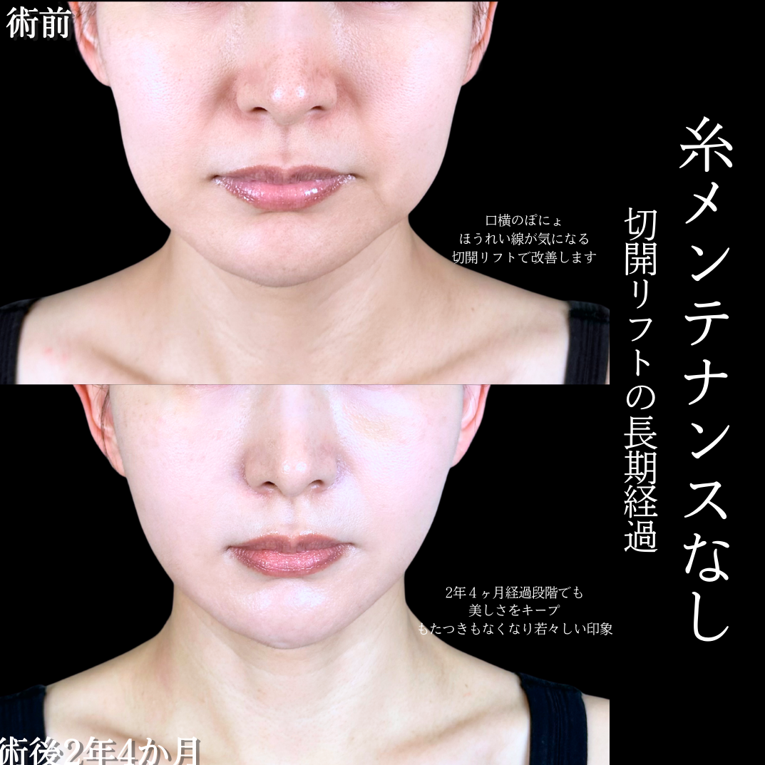 No.20082の症例写真1