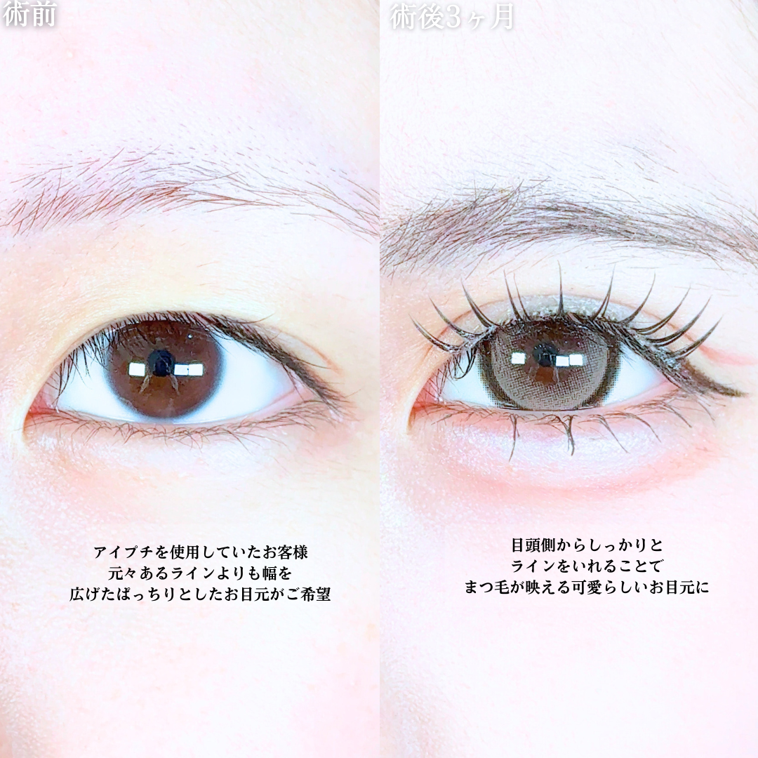 No.20105の症例写真1