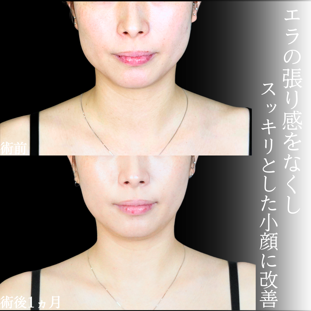 No.20114の症例写真1