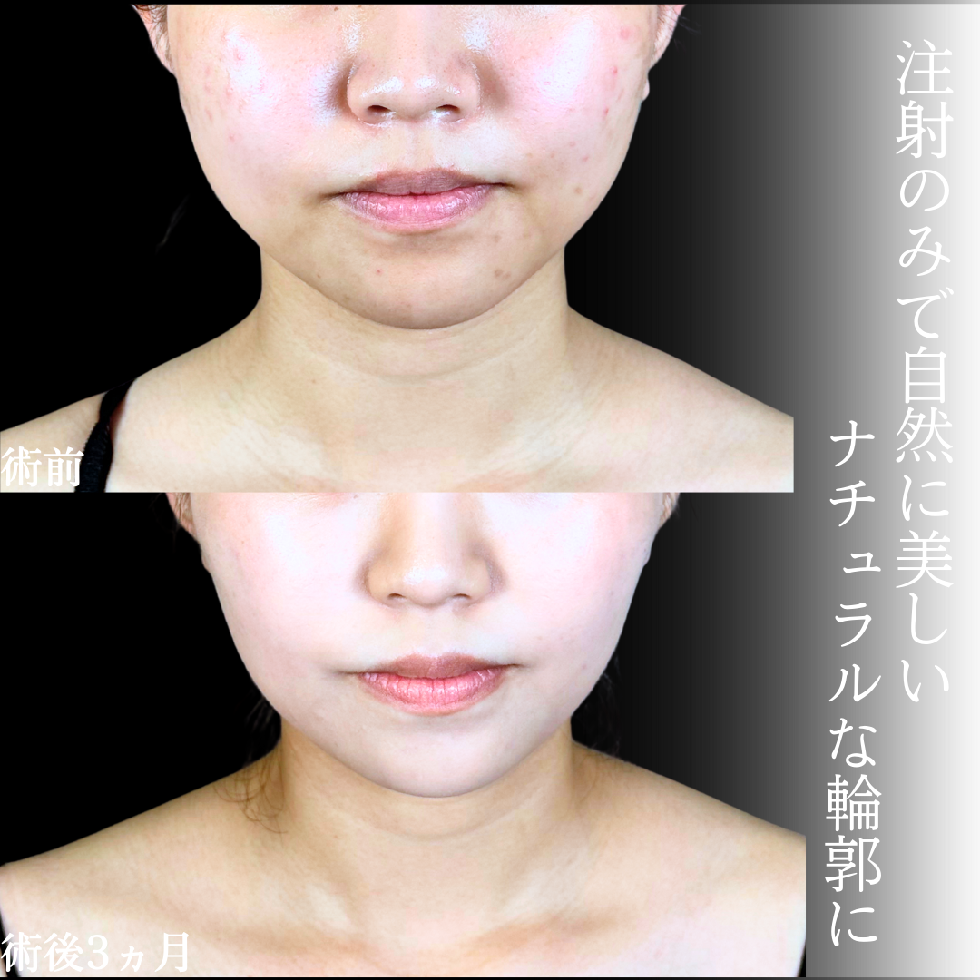 No.19838の症例写真1