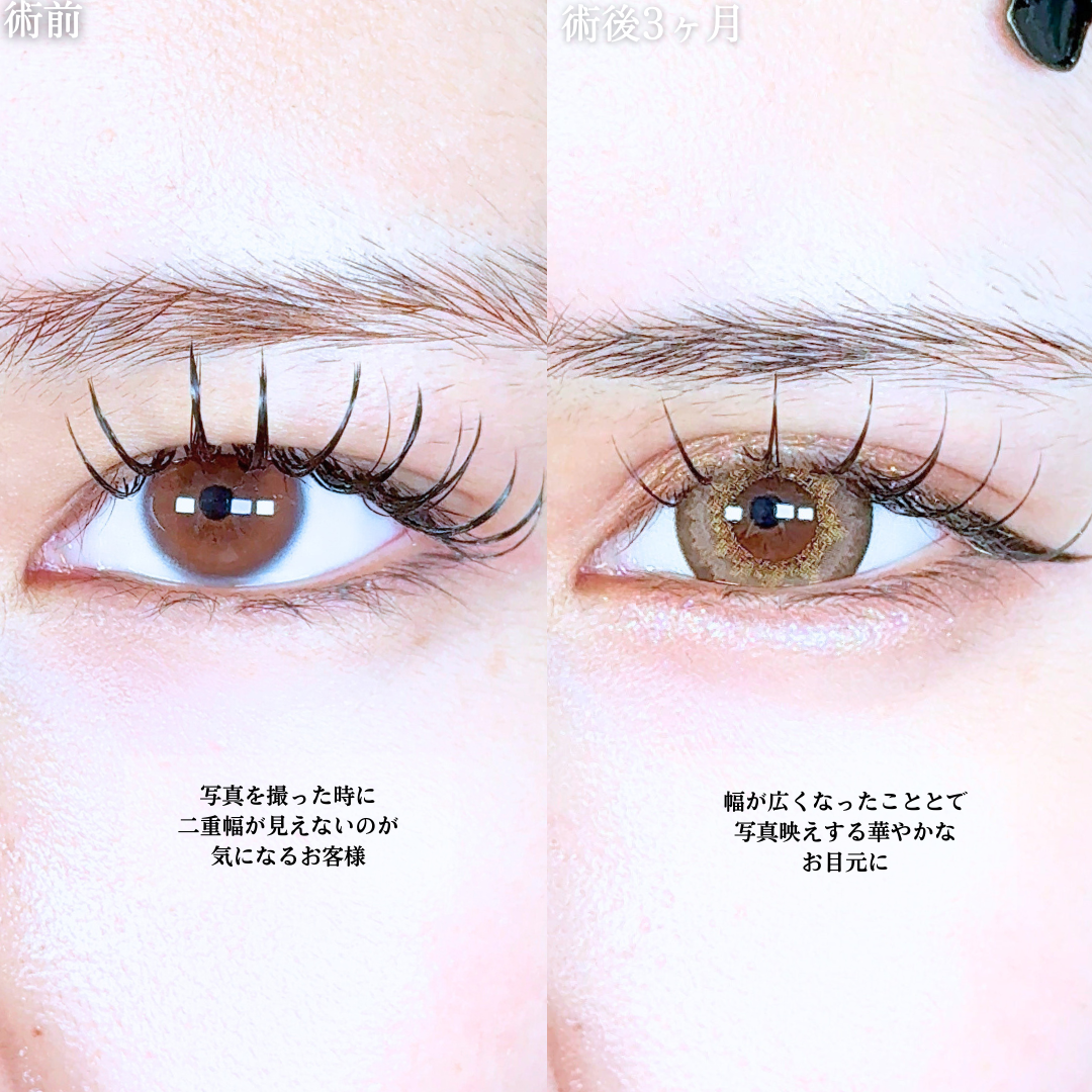 No.19879の症例写真1