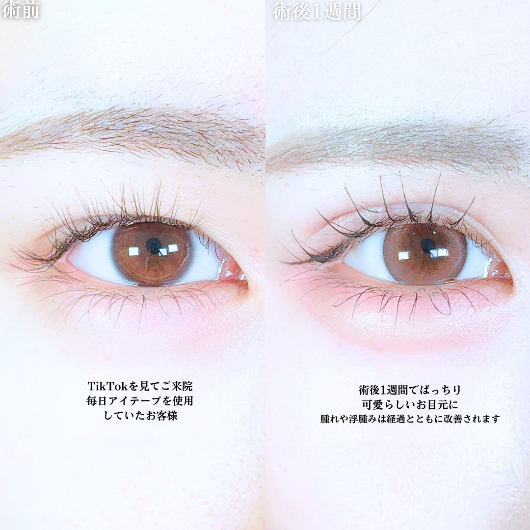 No.19944の症例写真1