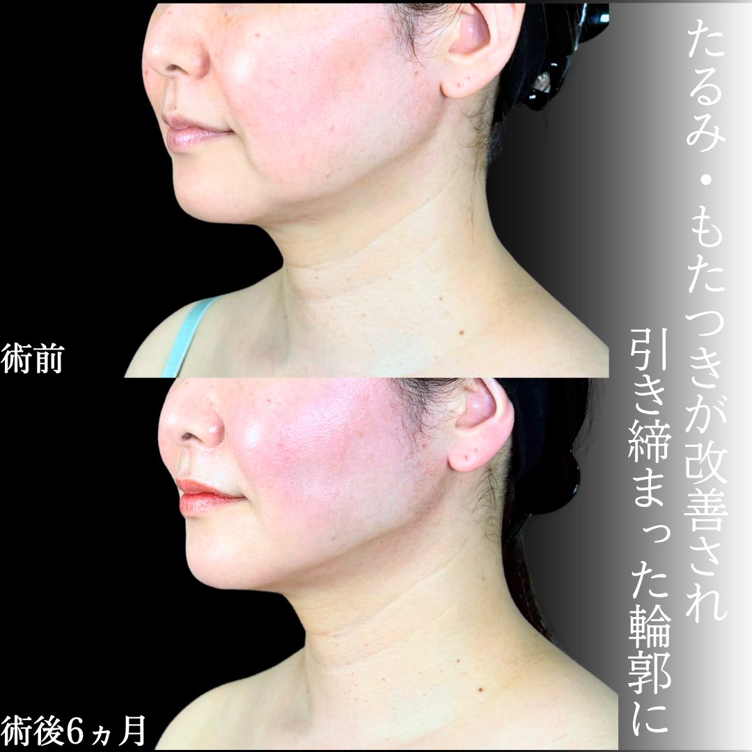 No.19970の症例写真1