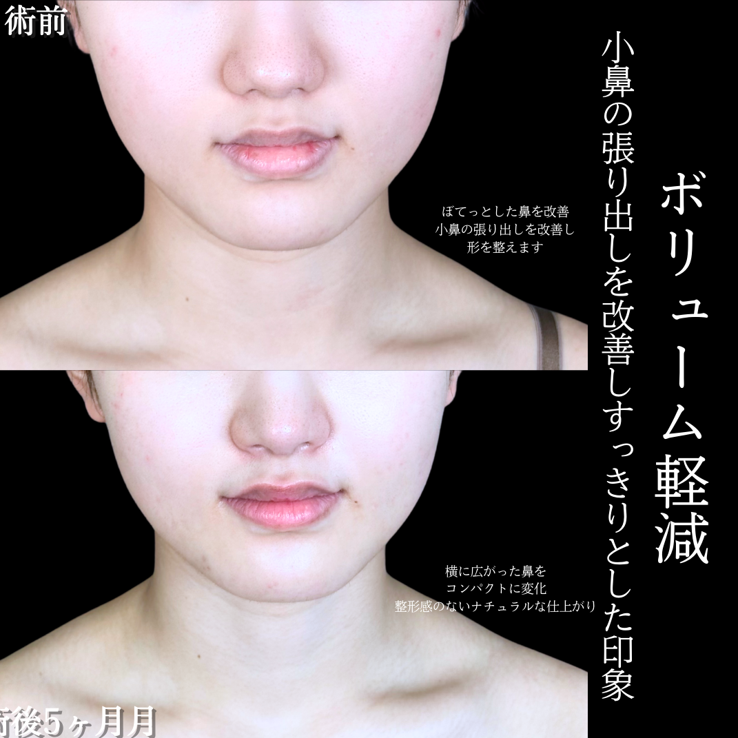 No.20066の症例写真1