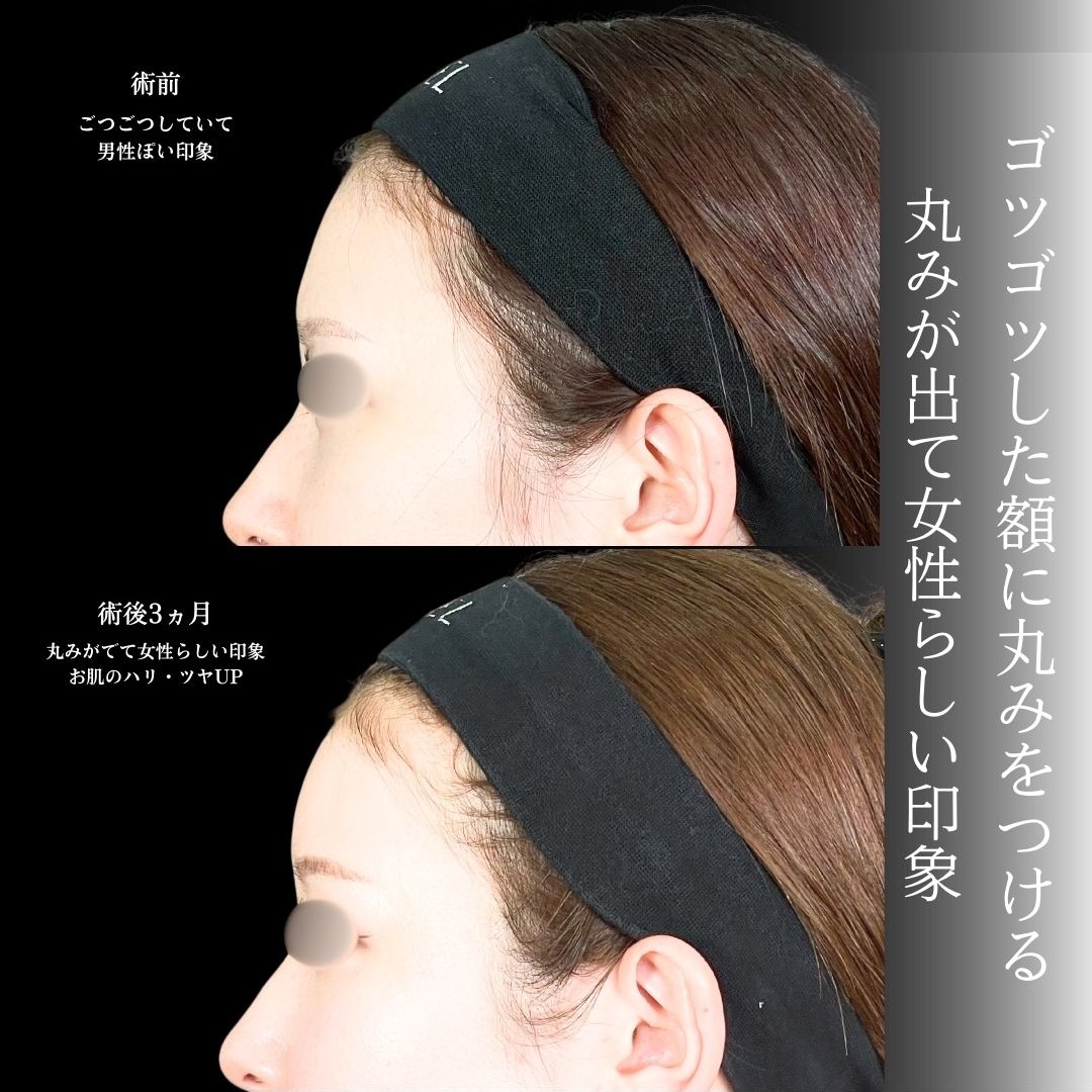 No.19784の症例写真1