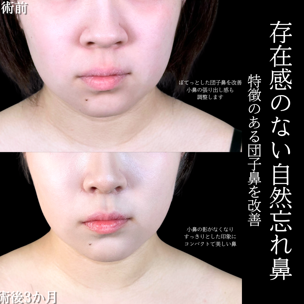 No.19777の症例写真1