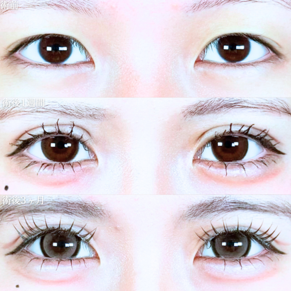 No.20090の症例写真