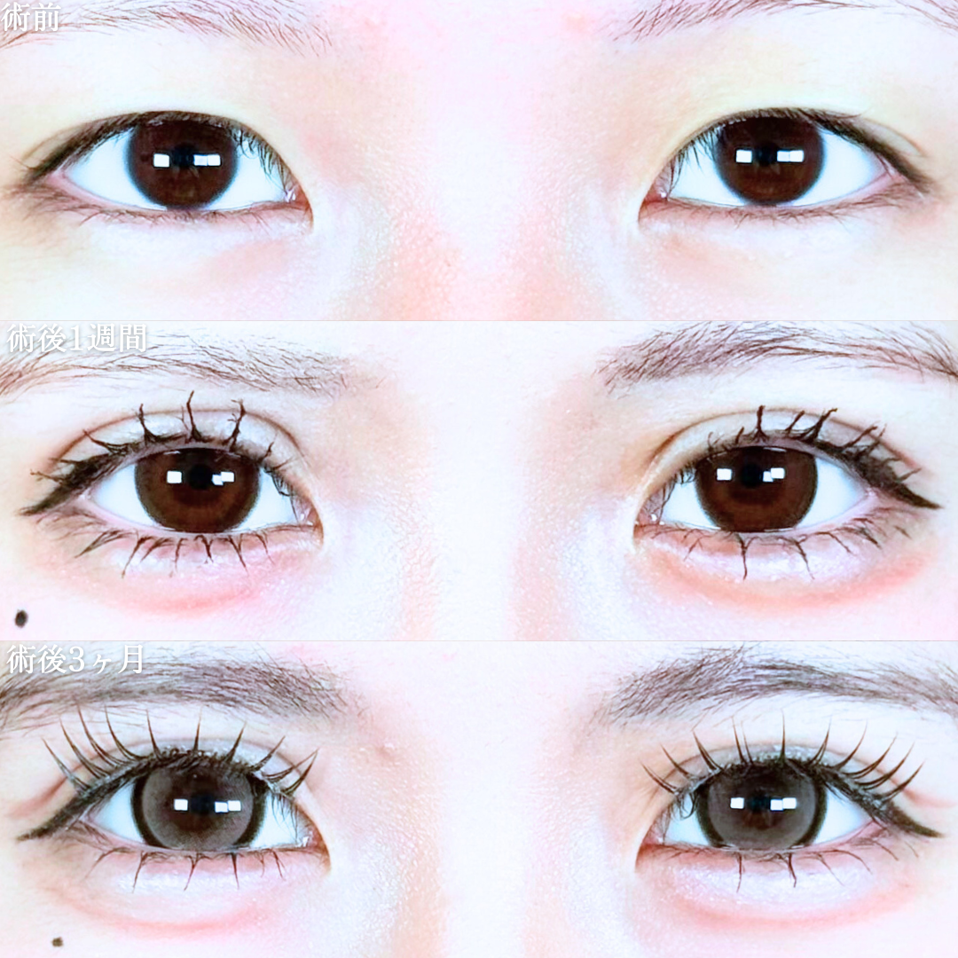 No.20090の症例写真