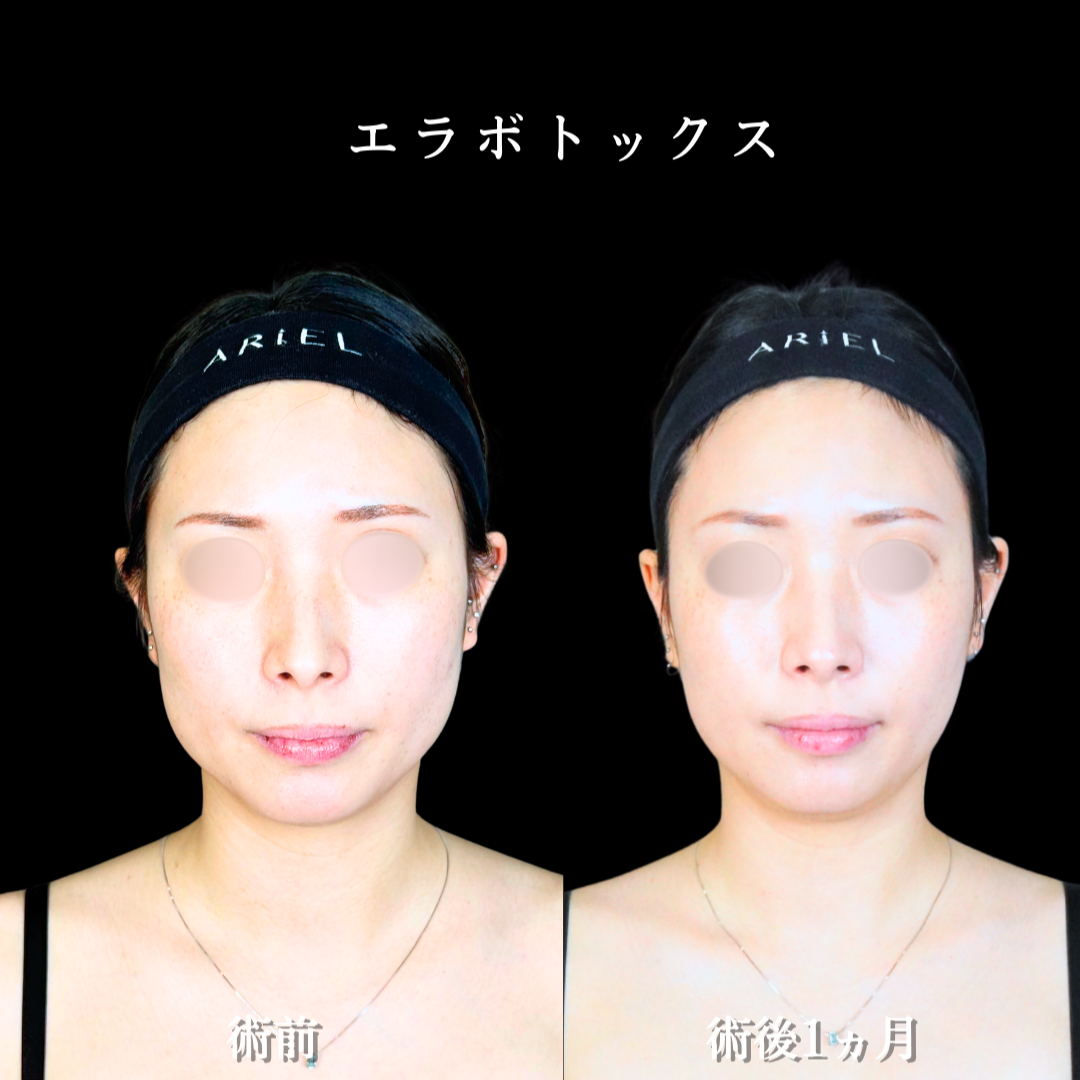 No.20114の症例写真2