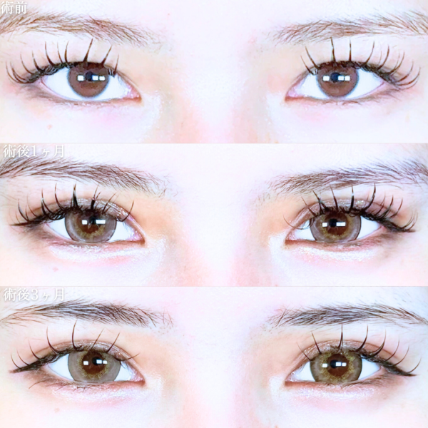 No.19874の症例写真