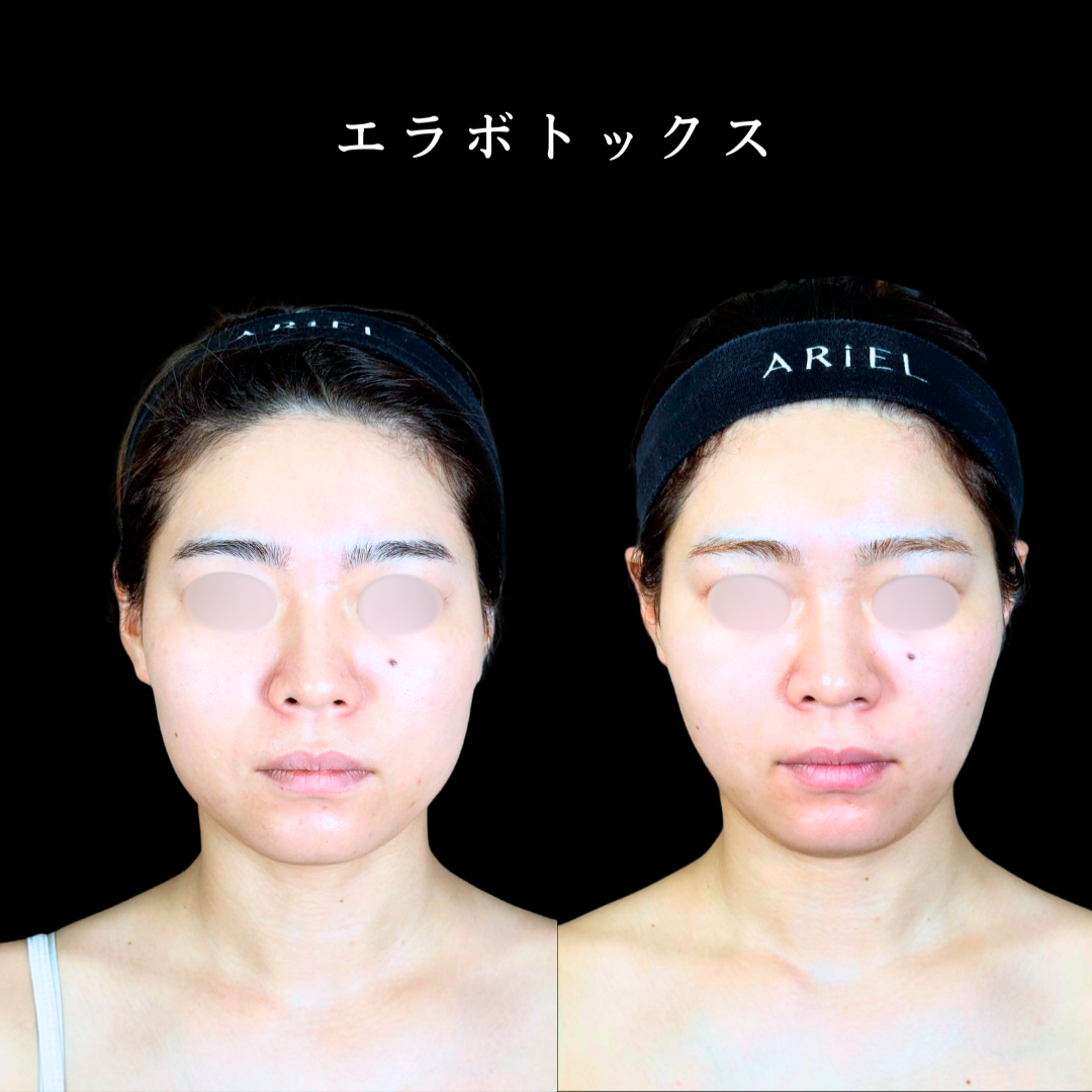 No.19925の症例写真2