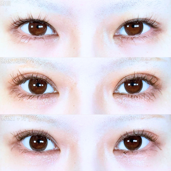 No.19927の症例写真