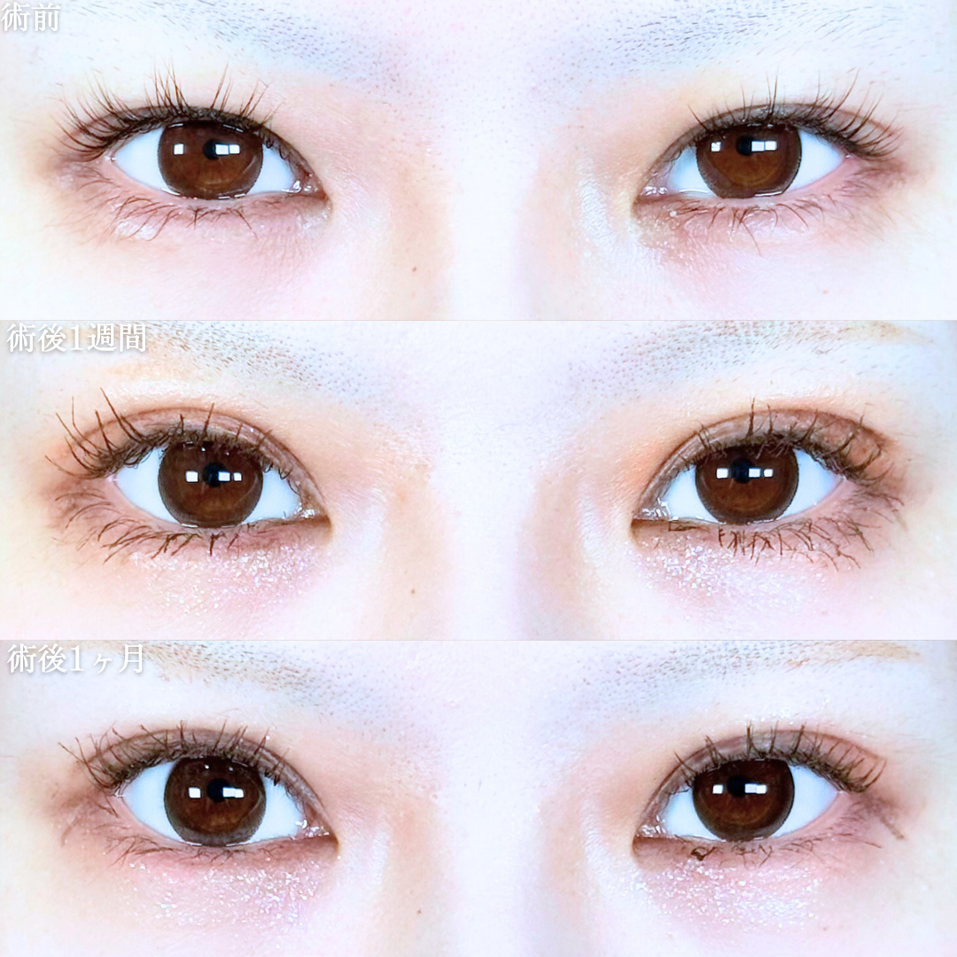 No.19927の症例写真