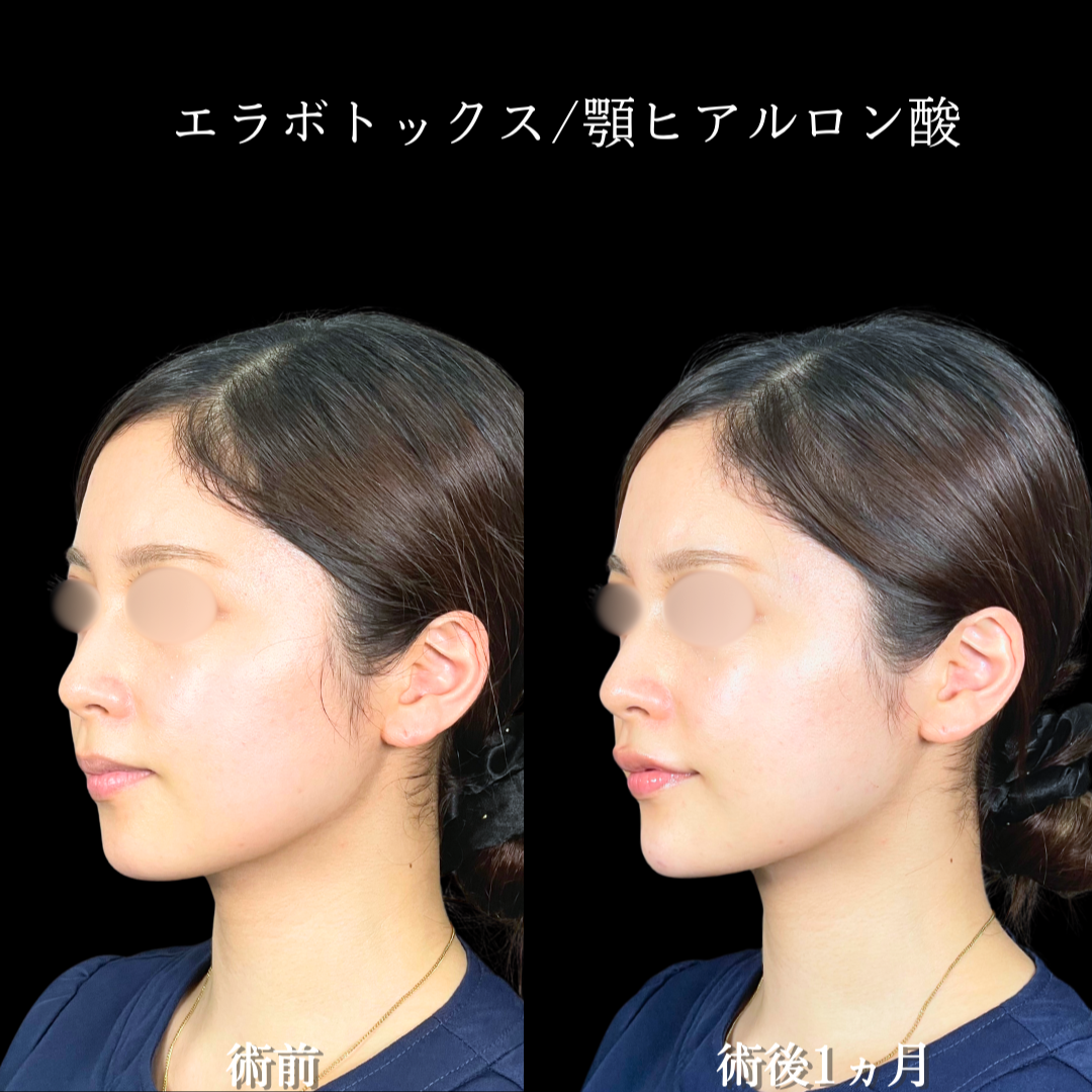 No.19951の症例写真2