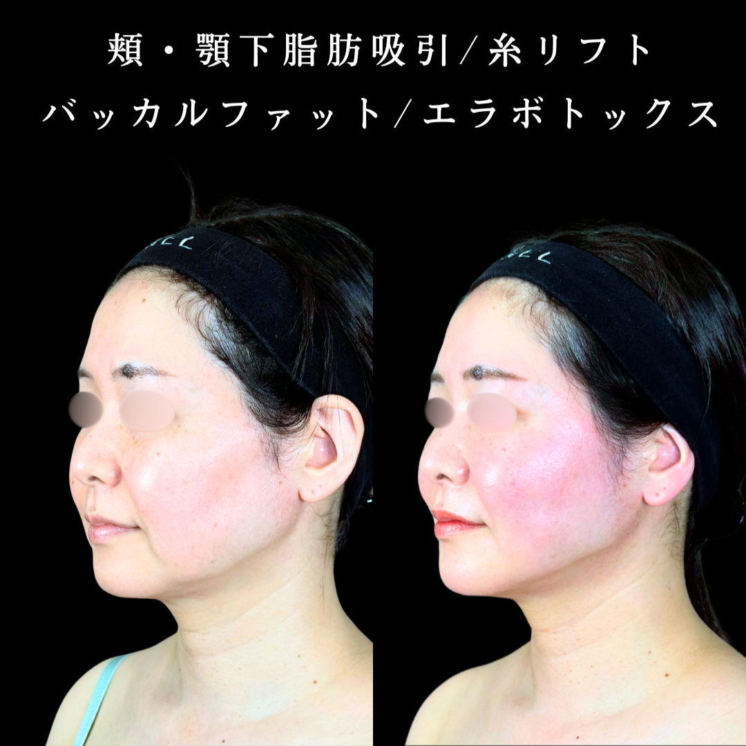 No.19970の症例写真2